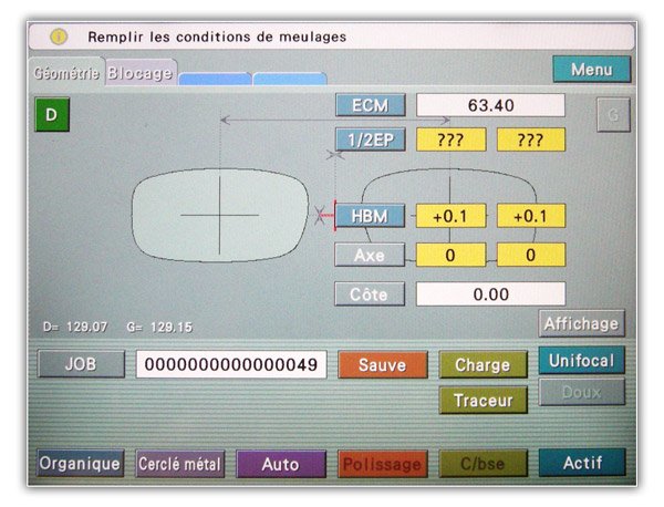 Saisie des donn&eacute;es de votre oeil (axage, &eacute;carts)